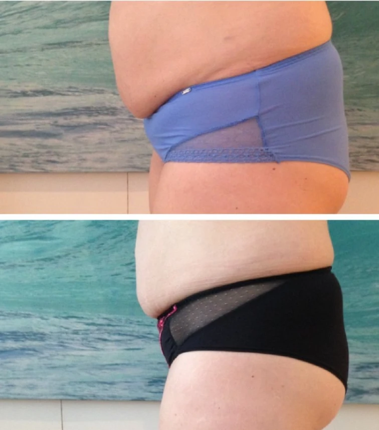 redustim jaslo efekty 2